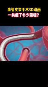 血管视频,揭秘人体血液循环的神奇之旅